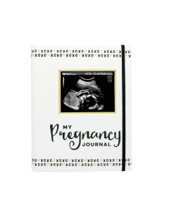 Pearhead Pregnancy Journal Black White & Gold